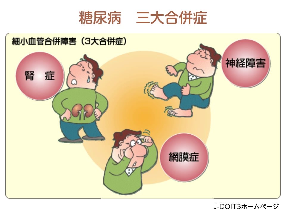 糖尿病の合併症を防ぐ方法