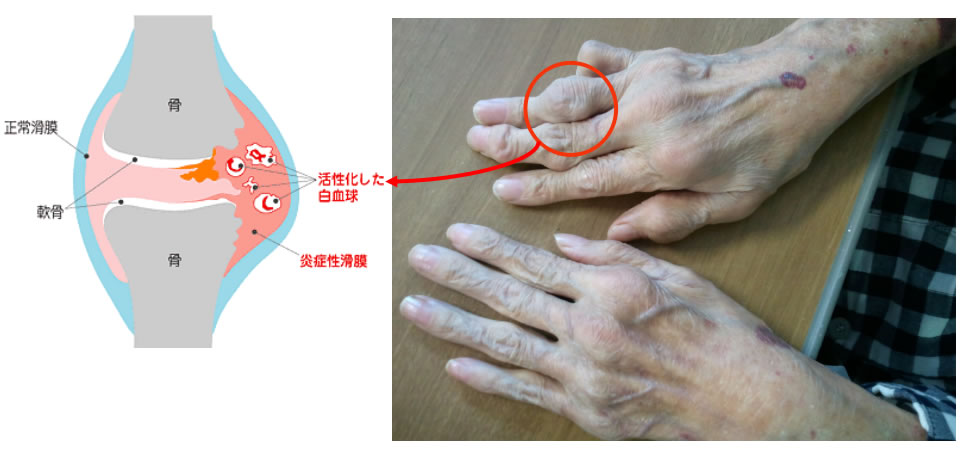 健康を守る方法